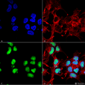 Rabbit Anti-Choline Acetyltransferase Antibody used in Immunocytochemistry/Immunofluorescence (ICC/IF) on Neuroblastoma cell line (SK-N-BE) (SPC-706)