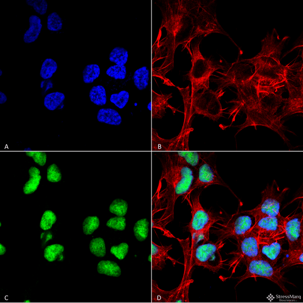 Rabbit Anti-Choline Acetyltransferase Antibody used in Immunocytochemistry/Immunofluorescence (ICC/IF) on Neuroblastoma cell line (SK-N-BE) (SPC-706)