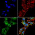 Rabbit Anti-Calcium Sensing Receptor Antibody used in Immunocytochemistry/Immunofluorescence (ICC/IF) on Neuroblastoma cell line (SK-N-BE) (SPC-713)