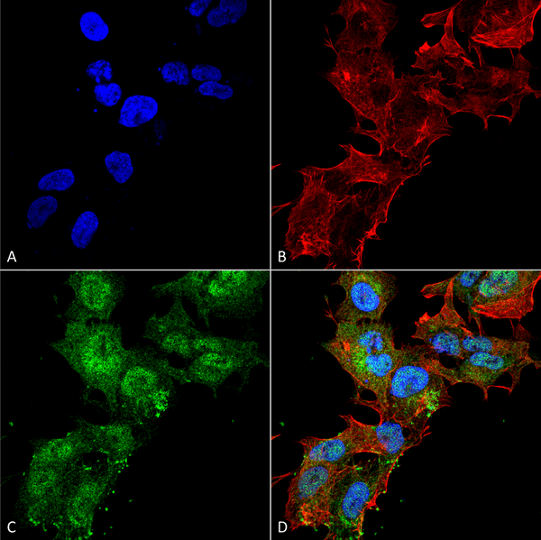 Rabbit Anti-Calcium Sensing Receptor Antibody used in Immunocytochemistry/Immunofluorescence (ICC/IF) on Neuroblastoma cell line (SK-N-BE) (SPC-713)