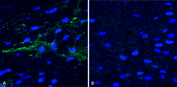 Rabbit Anti-Alpha Synuclein Antibody (pSer129) used in Immunohistochemistry (IHC) on Free floating brain sections (SPC-742)