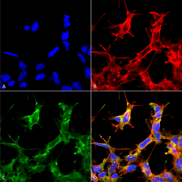 Rabbit Anti-HSP70 Antibody (Acetyl Lys77) used in Immunocytochemistry/Immunofluorescence (ICC/IF) on Embryonic kidney cells (HEK293) cultured overnight with 50 µM H2O2 (SPC-743)