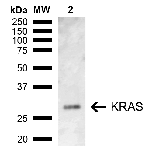Rabbit Anti-KRAS Antibody used in Western blot (WB) on Kidney (SPC-777)