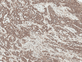 Rabbit Anti-SFRP2 Antibody used in Immunohistochemistry (IHC) on Liver (SPC-786)