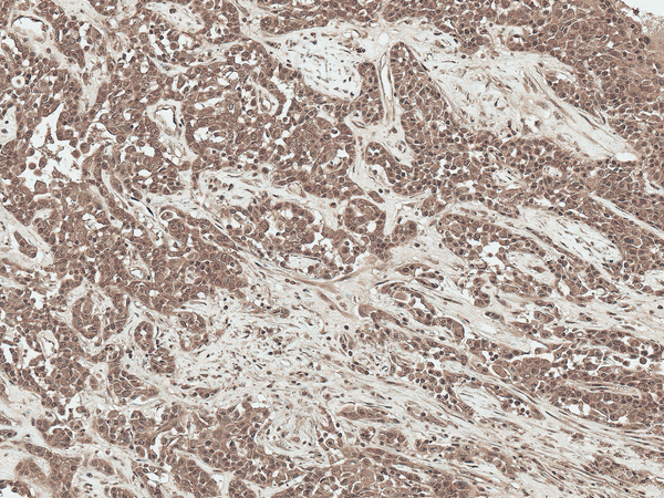 Rabbit Anti-SFRP2 Antibody used in Immunohistochemistry (IHC) on Liver (SPC-786)