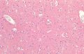 Rabbit Anti-Tau Antibody used in Immunohistochemistry (IHC) on Brain Cortex (SPC-802)