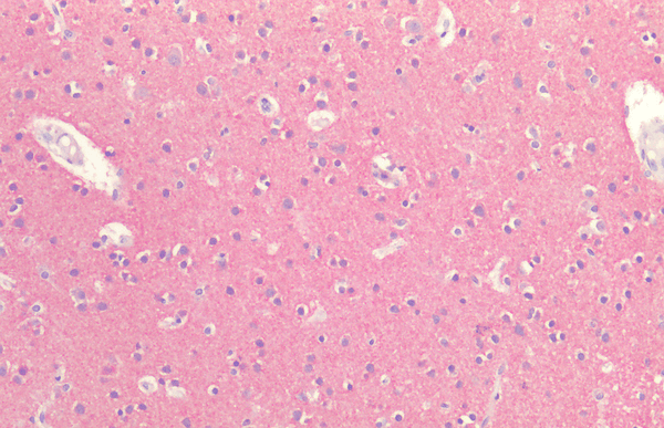 Rabbit Anti-Tau Antibody used in Immunohistochemistry (IHC) on Brain Cortex (SPC-802)