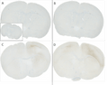 IHC of mouse brain injected with alpha synuclein monomers and fibrils | Mouse alpha Synuclein monomers (SPR-323) form new alpha synuclein fibrils through the seeding activity of Type 1 alpha synuclein pre-formed fibrils (SPR-324) as shown by increased fluorescence intensity by Thioflavin T over time. | SDS-Page of Mouse Recombinant Alpha Synuclein Protein Monomer (SPR-323)