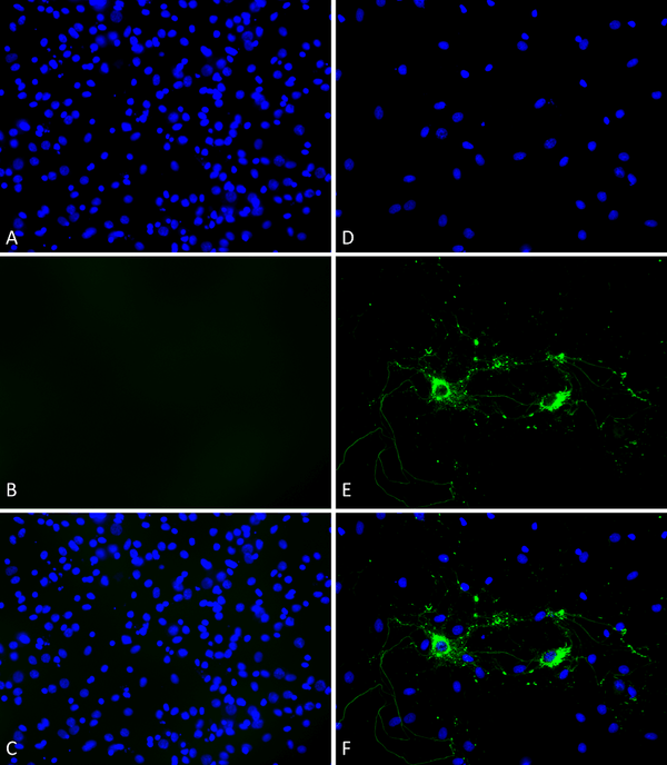 Alpha Synuclein Pre-formed Fibrils – Figure 1 of 9