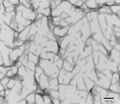 TEM of recombinant Tau441 (2N4R), P301S mutant Pre-formed Fibrils (PFFs) | TEM of recombinant Tau441 (2N4R), P301S mutant Pre-formed Fibrils (PFFs) | Thioflavin T emission curves show increased fluorescence (correlated to tau aggregation) when tau Pre-formed Fibrils (SPR-329) are combined with tau monomers (SPR-327). The Pre-formed Fibrils seed the formation of new fibrils from a pool of monomers. | SDS-PAGE of ~67 kDa Human Tau 2N4R P301S Pre-formed Fibrils (PFFs)