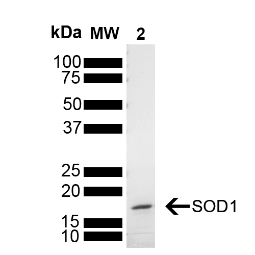 SDS-PAGE of SOD1 protein | Thioflavin T assay of SOD1 fibrils and monomers
