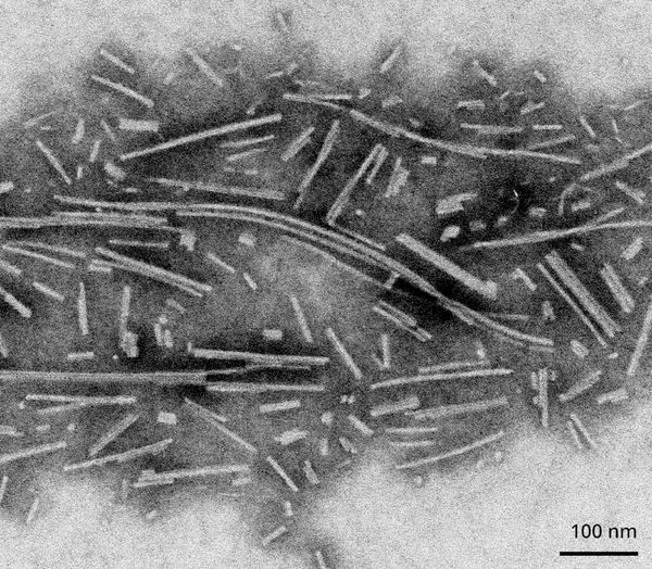 TEM of Active Human Recombinant Alpha Synuclein Protein Filaments (SPR-450) | TEM of Active Human Recombinant Alpha Synuclein Protein Filaments (SPR-450)