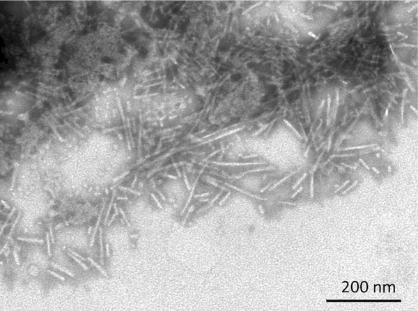 TEM of Active Human Recombinant Beta Synuclein Protein Pre-formed Fibrils (Type 1) (SPR-457) | Primary rat hippocampal neurons treated with human beta synuclein Pre-formed Fibrils (SPR-457)