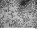 TEM of Human Recombinant Tau Protein Filaments (SPR-463) | TEM of Human Recombinant Tau Protein Filaments (SPR-463)
