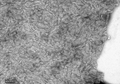 TEM of Human Recombinant Transthyretin L55P Variant Protein Filaments (SPR-464) | Turbidity Assay shows increased turbidity in Human Recombinant Transthyretin L55P Variant Protein Filaments (SPR-464)