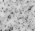 TEM of Human Recombinant Alpha Synuclein Oligomers (Dopamine HCL Stabilized) (SPR-466) | TEM of Human Recombinant Alpha Synuclein Oligomers (Dopamine HCL Stabilized) (SPR-466) | HPLC of Alpha Synuclein Oligomers (SPR-466) | LDH assay shows effect of alpha synuclein oligomers on mouse primary neurons | MTT assay shows effect of alpha synuclein oligomers on mouse primary neurons | Coomassie gel stain of alpha synuclein oligomer (SPR-466)