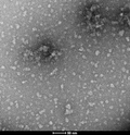 TEM of Epigallocatechin gallate (EGCG)-stabilized alpha synuclein oligomers (SPR-469)