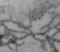 TEM of Mouse Tau PFFs (SPR-475)