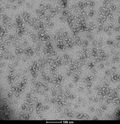 TEM of Human Recombinant Alpha Synuclein Oligomers (Kinetically Stable) (SPR-484). | Native PAGE of Human Recombinant Alpha Synuclein Oligomers (Kinetically Stable) (SPR-484). | Toxicity of Human Recombinant Alpha Synuclein Oligomers (Kinetically Stable) (SPR-484). | IHC of Human Recombinant Alpha Synuclein Oligomers (Kinetically Stable) (SPR-484).