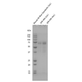 SDS-PAGE of Human Tau-441 (2N4R) Wild-Type Monomers (Baculovirus/Sf9) Protein (SPR-496) | Dot Blot of Human Tau-441 (2N4R) Wild-Type Monomers (Baculovirus/Sf9) Protein (SPR-496) | Mass Spec Table of Human Tau-441 (2N4R) Wild-Type Monomers (Baculovirus/Sf9) Protein (SPR-496)
