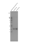 SDS-Page of Human Human Recombinant Alpha Synuclein S87N Mutant Monomers Protein (SPR-499) | Thioflavin T assay of Human Human Recombinant Alpha Synuclein S87N Mutant Monomers Protein (SPR-499)