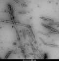 TEM of Human Tau dGAE (297-391) AD-mimic Pre-formed Fibrils Protein (SPR-502) | SDS-Page of Human Tau dGAE (297-391) AD-mimic Pre-formed Fibrils Protein (SPR-502) | TEM of Human Tau dGAE (297-391) AD-mimic Pre-formed Fibrils Protein (SPR-502) | TEM of Human Tau dGAE (297-391) AD-mimic Pre-formed Fibrils Protein (SPR-502)