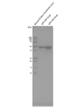 SDS-PAGE of Tau-383 (ON4R) Wild-Type Monomers (SPR-509) | THT Assay of Tau-383 (ON4R) Wild-Type Monomers (SPR-509)