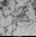 TEM of Tau-381 (1N3R) Wild-Type Pre-formed Fibrils Protein (SPR-514) | Thioflavin T assay of Tau-381 (1N3R) Wild-Type Pre-formed Fibrils Protein (SPR-514) | Sedimentation assay of Tau-381 (1N3R) Wild-Type Pre-formed Fibrils Protein (SPR-514) | TEM of Tau-381 (1N3R) Wild-Type Pre-formed Fibrils Protein (SPR-514) | SDS-PAGE of Tau-381 (1N3R) Wild-Type Pre-formed Fibrils Protein (SPR-514)
