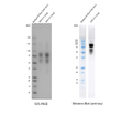SDS-PAGE and anti-tau western blot of SPR-515. | SDS-PAGE of SPR-515 glycosylation. | Mass spectrometry of human P301S Tau 2N4R monomers expressed using CHO cells (SPR-515). | Mass spectrometry of human P301S Tau 2N4R monomers expressed using CHO cells (SPR-515). | Dot Blot of purified hTau (2N4R) P301S monomers (SPR-515)