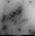 Representative TEM image of Human Recombinant Alpha Synuclein pSer129 Pre-Formed Fibrils (SPR-521), 200nm scale. Negative stain transmission electron microscopy images of SPR-521 acquired at 80 Kv on carbon coated 400 mesh copper grids using phosphotungstic acid and uranyl acetate stain.