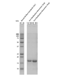 SDS-Page of Tau (K18) P301L Mutant Pre-formed Fibrils (SPR-523) | TEM of Tau (K18) P301L Mutant Pre-formed Fibrils (SPR-523) | Native-PAGE of Tau (K18) P301L Mutant Pre-formed Fibrils (SPR-523) | Thioflavin T assay of Tau (K18) P301L Mutant Pre-formed Fibrils (SPR-523) | TEM of Tau (K18) P301L Mutant Pre-formed Fibrils (SPR-523) | AFM of Tau (K18) P301L Mutant Pre-formed Fibrils (SPR-523) | Toxicity of Tau (K18) P301L Mutant Pre-formed Fibrils (SPR-523)