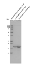 SDS-Page of Tau (K18) Wild-Type Pre-formed Fibrils (SPR-525) | TEM of Tau (K18) Wild-Type Pre-formed Fibrils (SPR-525) | Sedimentation assay of Tau (K18) Wild-Type Pre-formed Fibrils (SPR-525) | Thioflavin T assay of Tau (K18) Wild-Type Pre-formed Fibrils (SPR-525) | TEM of Tau (K18) Wild-Type Pre-formed Fibrils (SPR-525)