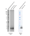 SDS-Page of Amyloid Beta Peptide 1-40 Monomers (SPR-530)