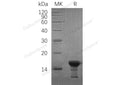 Recombinant Human γ-Synuclein/SNCG Protein – Figure 1 of 2