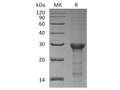 Recombinant Human STAT6 Protein (E.coli, His Tag) – Figure 1 of 2