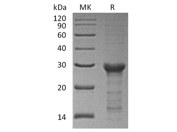 Recombinant Human STAT6 Protein (E.coli, His Tag) – Figure 1 of 2