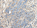 PLA2G16 Polyclonal Antibody – Figure 1 of 3