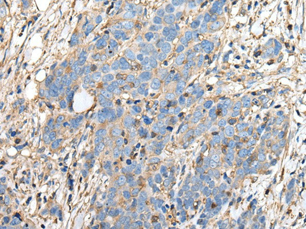 PLA2G16 Polyclonal Antibody – Figure 1 of 3