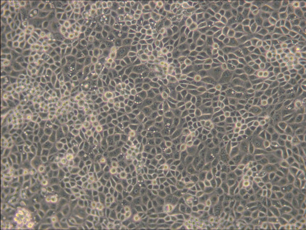ST cell