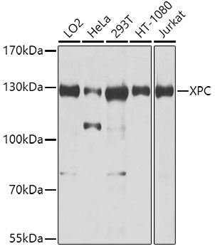Anti-XPC antibody (700-940) (STJ110652) – Figure 1 of 1