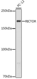 Anti-RICTOR antibody (1043-1708) (STJ11100924) – Figure 1 of 1