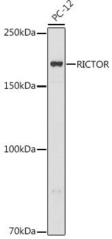 Anti-RICTOR antibody (1043-1708) (STJ11100924) – Figure 1 of 1