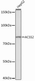 Anti-ACSS2 antibody (50-150) [S8MR] (STJ11101408) - Figure 1 of 2