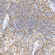 Anti-MAPK8/MAPK9/MAPK10 antibody (1-370) (STJ11101473) – Figure 1 of 1