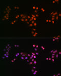 Anti-DROSHA antibody (1-100) [S2MR] (STJ11101722) – Figure 1 of 1