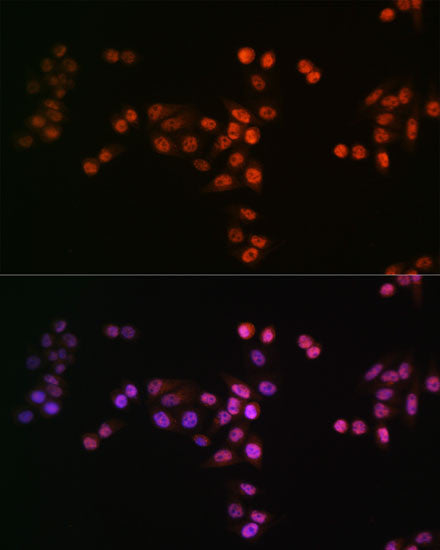 Anti-DROSHA antibody (1-100) [S2MR] (STJ11101722) – Figure 1 of 1