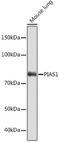 Anti-PIAS1 antibody (3-101) [S6MR] (STJ11102146) – Figure 1 of 1