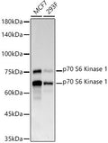 Anti-RPS6KB1 antibody (1-100) [S8MR] (STJ11102188) – Figure 1 of 1