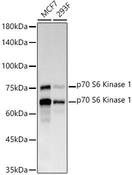 Anti-RPS6KB1 antibody (1-100) [S8MR] (STJ11102188) – Figure 1 of 1