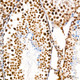Anti-DDX17 antibody (100-200) [S3MR] (STJ11102313) – Figure 1 of 1